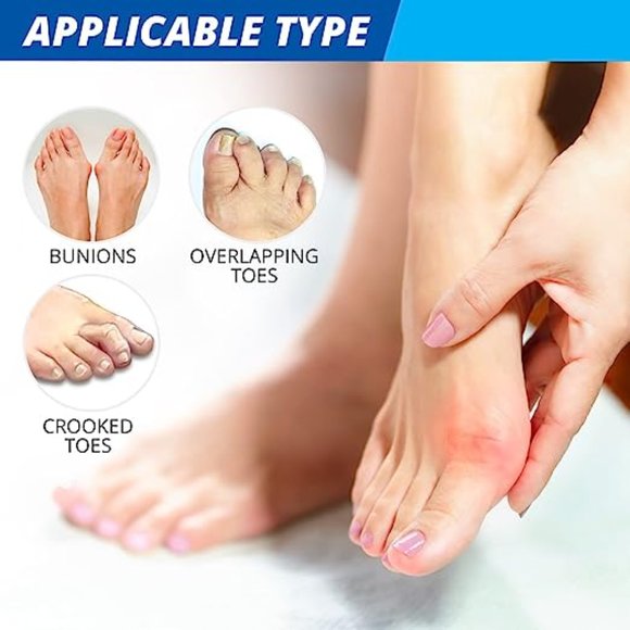 Bunion Correction Kit BUY 1 GET 1 FREE - Picture 2 of 4